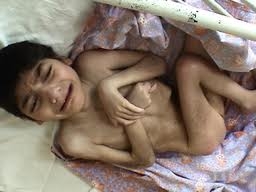 The Worldwide Campaign to End the Institutionalization of Children